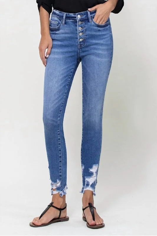 Casual Attire For Women Holly Exposed Button Skinny Jean In Medium Wash